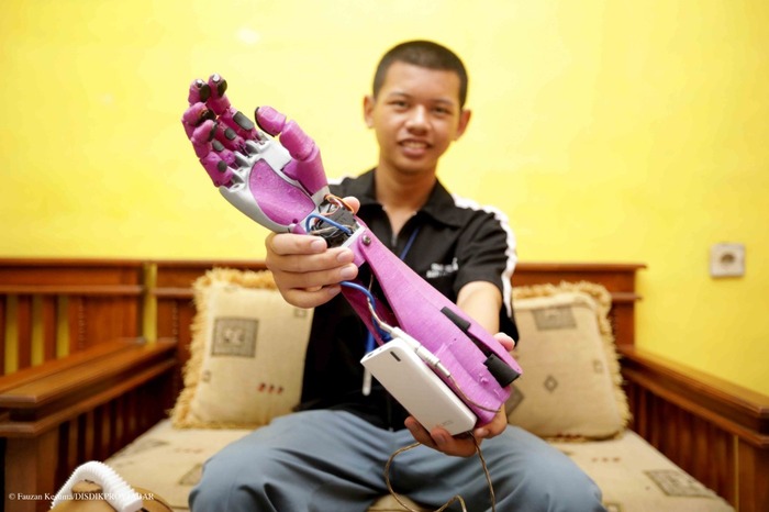 Miris Lihat Teman Tak Punya Jari, Siswa SMK Ciptakan Lengan Robot