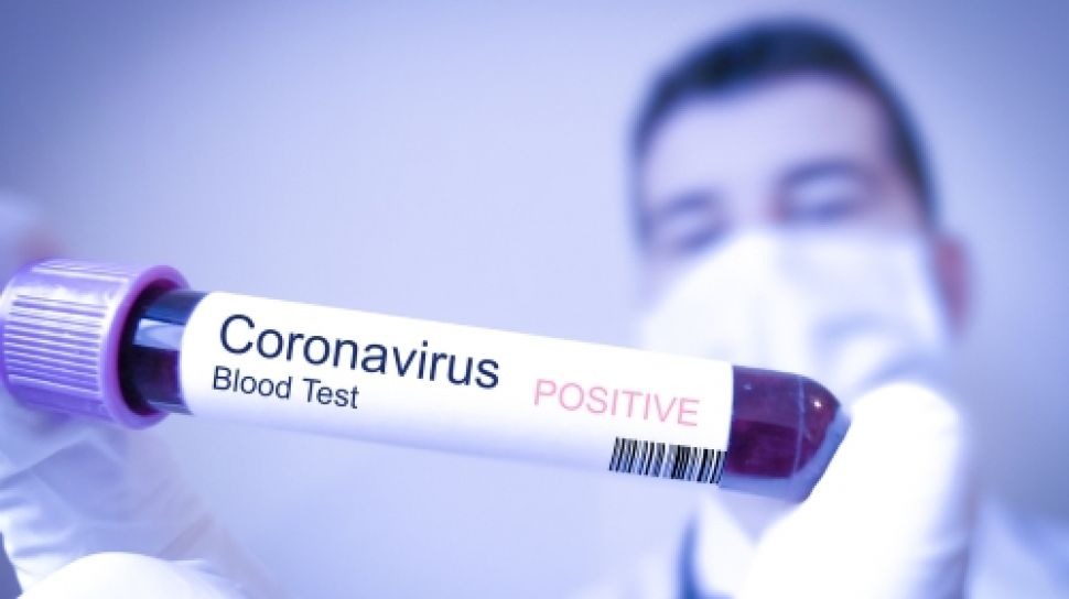 Pulang dari Bali, 38 Wakil Rakyat ODP Virus Corona