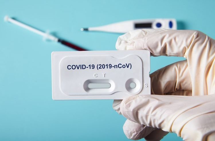 Rapid Test Kit Covid-19 Diujicoba di RS Hasan Sadikin Bandung