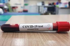 Hasil Rapid Test di RSDP, Ibu Hamil Warga Padarincang Negatif Covid-19