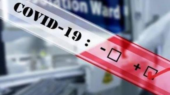 Ribuan Rapid Test Disebar di Banten, Begini Hasilnya