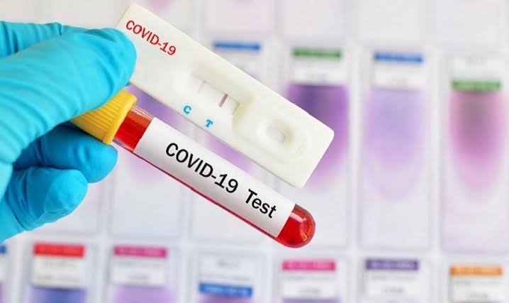 Kabar Baik, Indonesia Produksi Alat Rapid Test Sendiri Hingga 10 Ribu