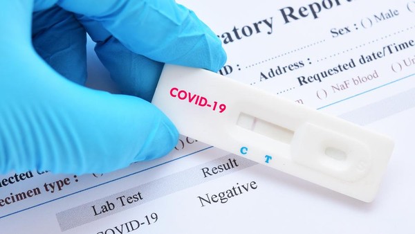 MPR Minta Pemerintah Turun Tangan Terkait Potensi Bisnis Rapid Test